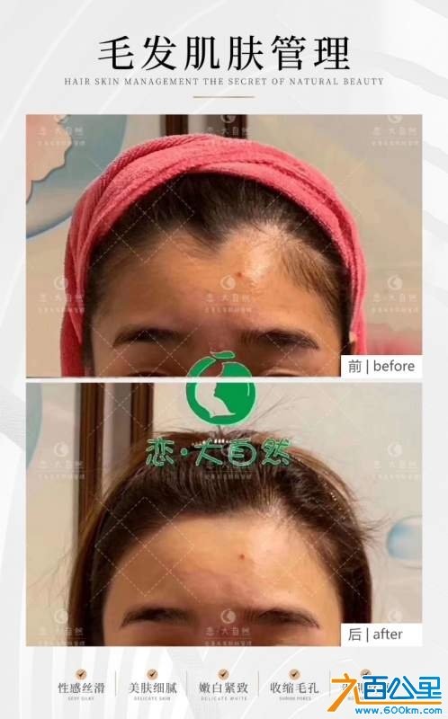 wechat_upload173061992867272a18ac05c